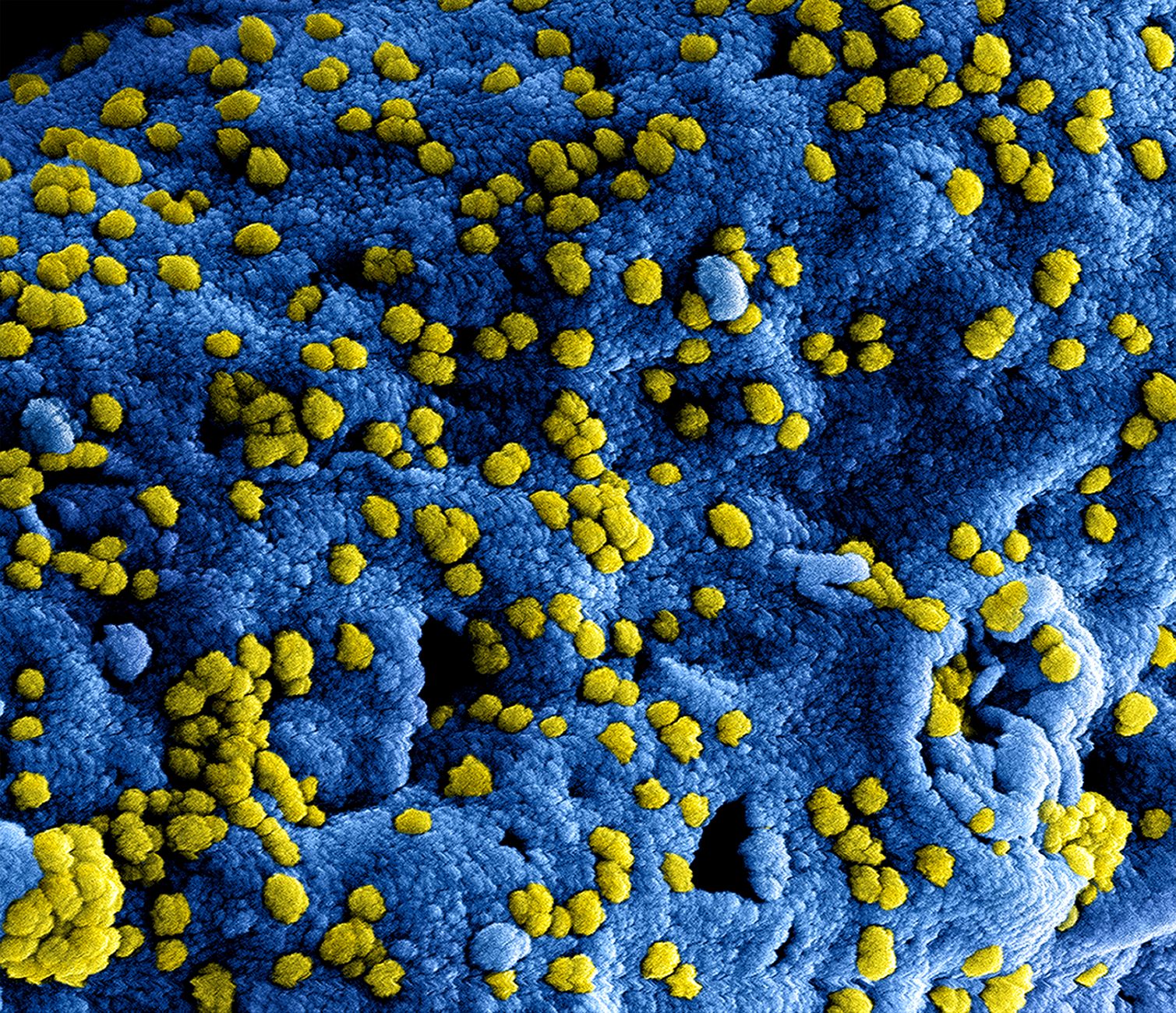 Your DNA Contains Viral Code From Ancient Infections